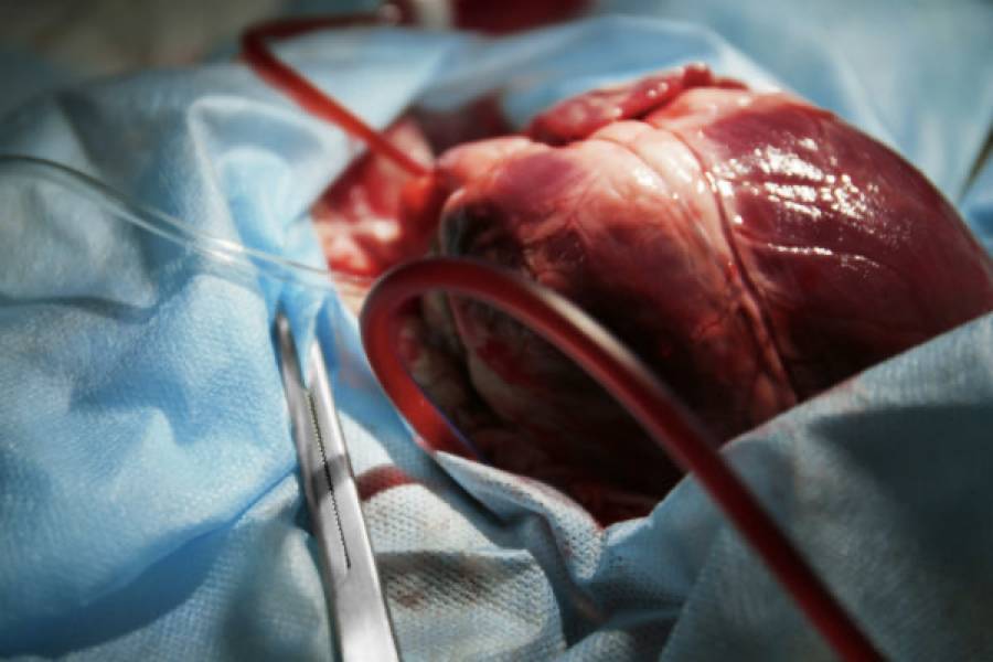 ADVANCED Heart Failure: Pathophysiology & Treatments including Heart Transplant!